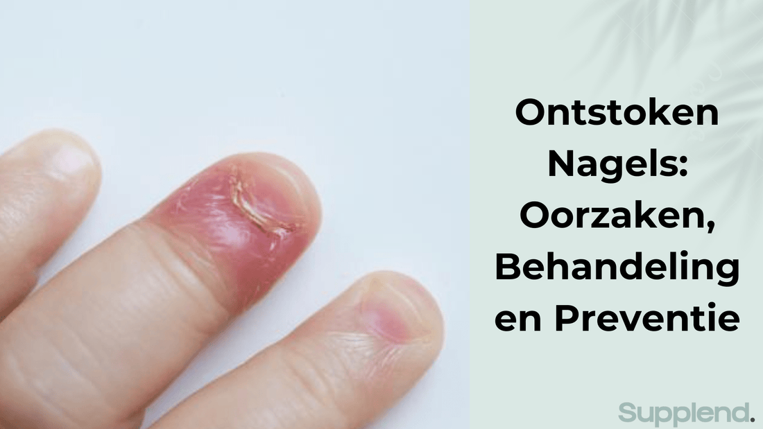Ontstoken Nagels: Oorzaken, Behandeling en Preventie