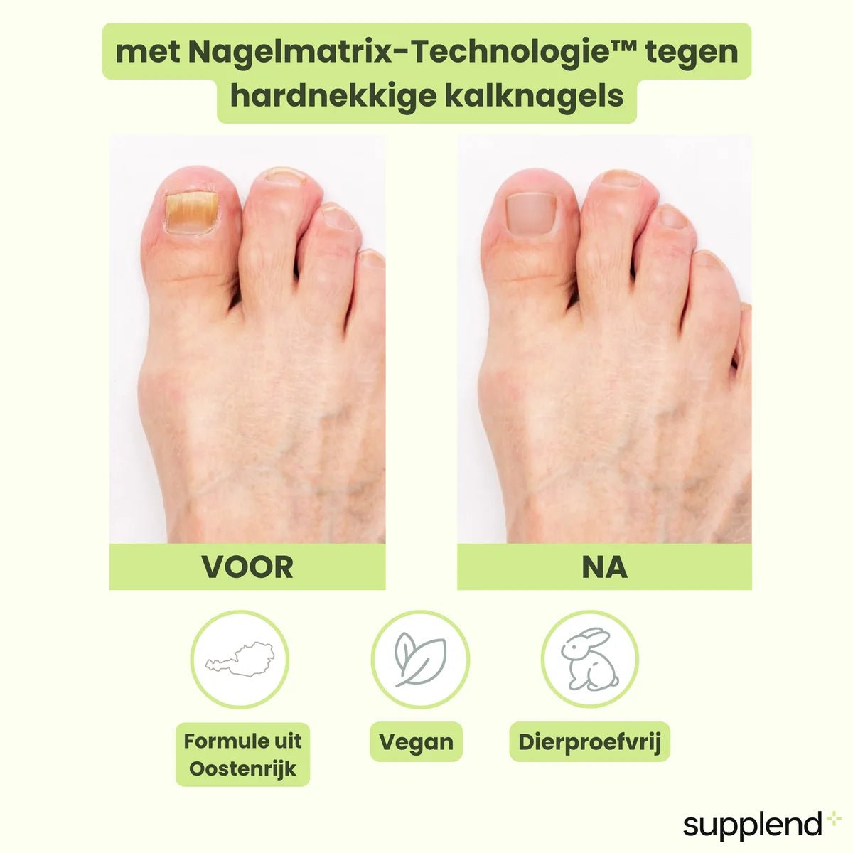 Voor en na behandeling met Supplend